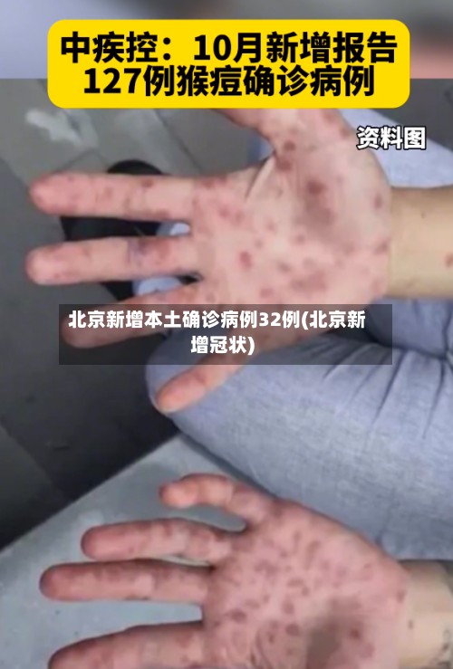 北京新增本土确诊病例32例(北京新增冠状)-第2张图片