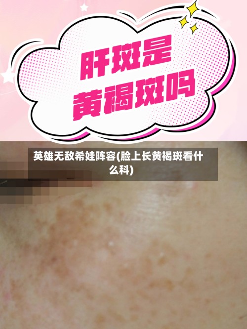 英雄无敌希娃阵容(脸上长黄褐斑看什么科)-第3张图片
