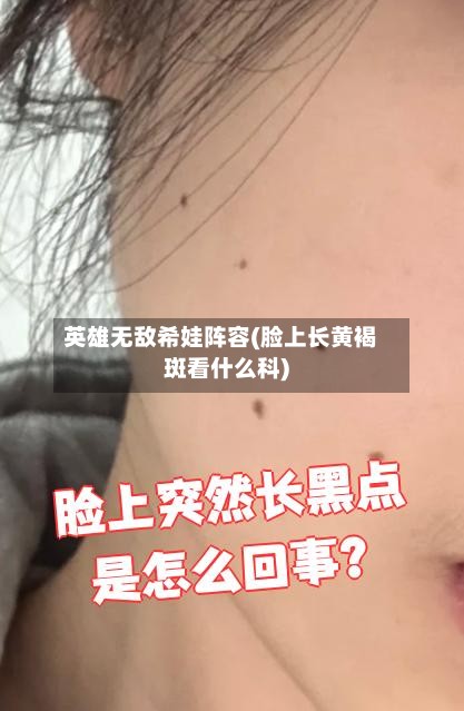 英雄无敌希娃阵容(脸上长黄褐斑看什么科)-第2张图片