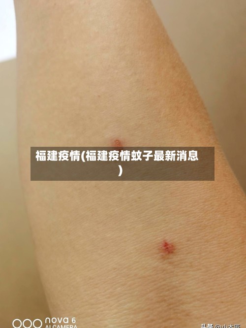 福建疫情(福建疫情蚊子最新消息)