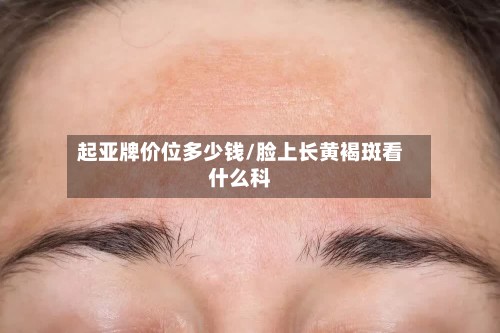起亚牌价位多少钱/脸上长黄褐斑看什么科