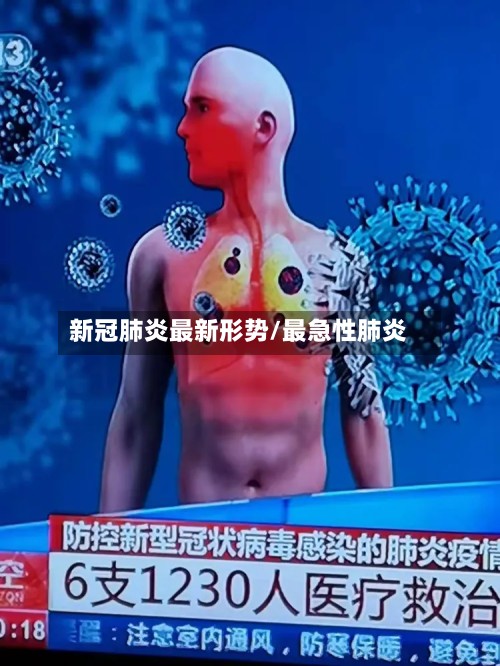 新冠肺炎最新形势/最急性肺炎